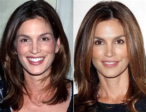 cindy crawford nose|Cindy Crawford Before and After Plastic Surgery